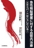 急性期脳梗塞に対する血管内治療ーエキスパートはこうしている！